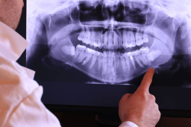 Best Emergency Dentist for Lost Fillings or Crowns in Skiato, OK