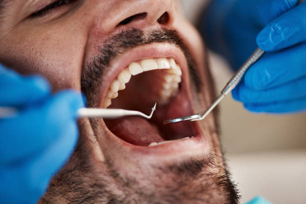 Best Weekend Emergency Dentist in Skiato, OK