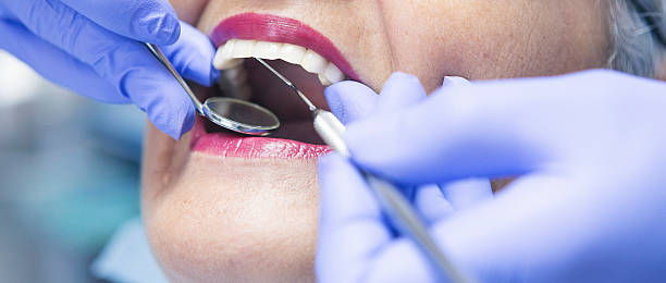 Best Emergency Dentist for Lost Fillings or Crowns in Skiato, OK